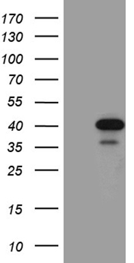 HEK293T cells were transfected with the pCMV6-ENTRY control (Left lane) or pCMV6-ENTRY SULT1A3 (Right lane) cDNA for 48 hrs and lysed