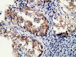 Immunohistochemical staining of paraffin-embedded Human pancreas tissue within the normal limits using anti-SH2B3 mouse monoclonal antibody