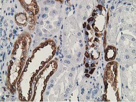 Immunohistochemical staining of paraffin-embedded Human Kidney tissue within the normal limits using anti-SH2B3 mouse monoclonal antibody