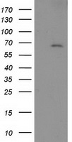 HEK293T cells were transfected with the pCMV6-ENTRY control (Left lane) or pCMV6-ENTRY SH2B3 (Right lane) cDNA for 48 hrs and lysed