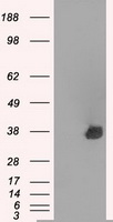 HEK293T cells were transfected with the pCMV6-ENTRY control (Left lane) or pCMV6-ENTRY AURKC (Right lane) cDNA for 48 hrs and lysed