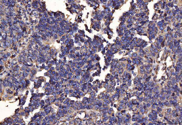 m03813 1 pdia6 primary antibodies ihc testing 2