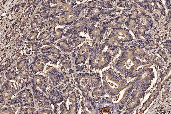 m03813 1 pdia6 primary antibodies ihc testing 4