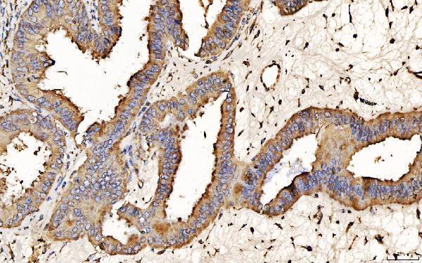 m03813 1 pdia6 primary antibodies ihc testing 5