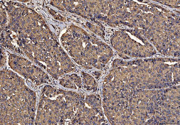 m03813 1 pdia6 primary antibodies ihc testing 7