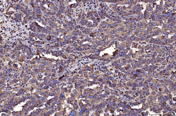 m03813 1 pdia6 primary antibodies ihc testing 8