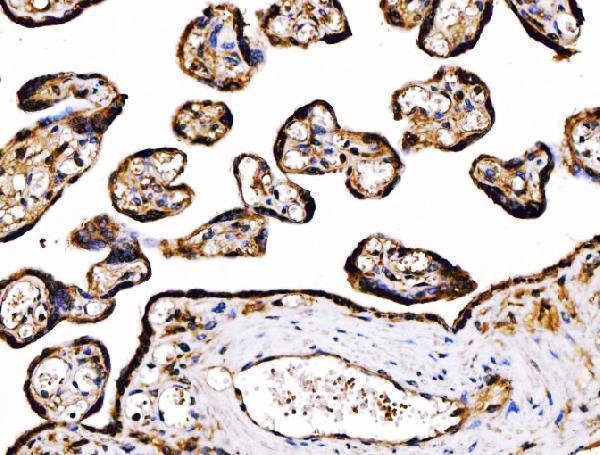 m03813 1 pdia6 primary antibodies ihc testing 9
