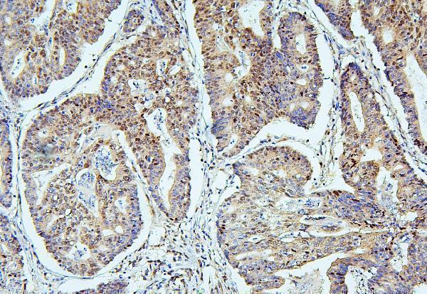 m03816 2 uba2 primary antibodies ihc testing 2