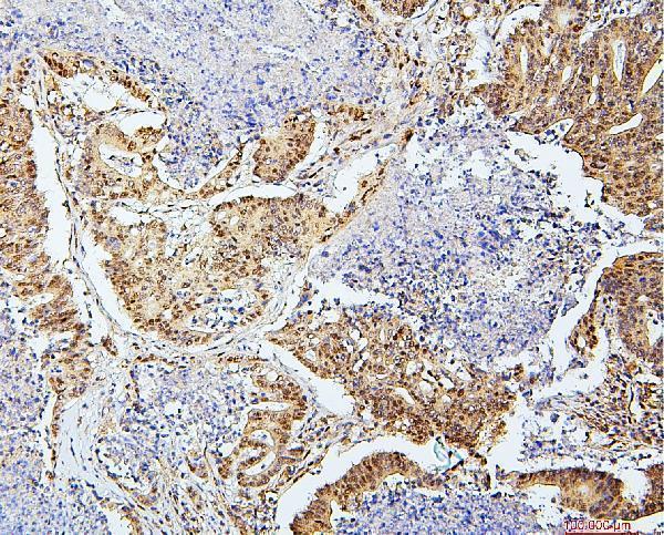 m03816 2 uba2 primary antibodies ihc testing 3