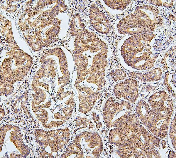 m03816 2 uba2 primary antibodies ihc testing 4