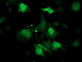 m03820 1 anti rbp1 mouse monoclonal antibody clone id oti2h3 if testing 10