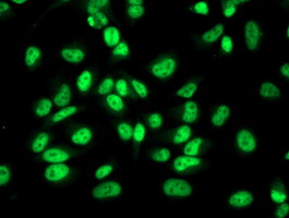 m03820 1 anti rbp1 mouse monoclonal antibody clone id oti2h3 if testing 11