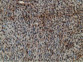 Immunohistochemical staining of paraffin-embedded Human Ovary tissue within the normal limits using anti-RBP1 mouse monoclonal antibody