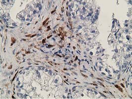 m03820 1 anti rbp1 mouse monoclonal antibody clone id oti2h3 ihc testing 4