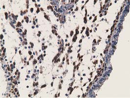 m03820 1 anti rbp1 mouse monoclonal antibody clone id oti2h3 ihc testing 5