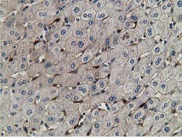 m03820 1 anti rbp1 mouse monoclonal antibody clone id oti2h3 ihc testing 6