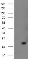 HEK293T cells were transfected with the pCMV6-ENTRY control (Left lane) or pCMV6-ENTRY RBP1 (Right lane) cDNA for 48 hrs and lysed