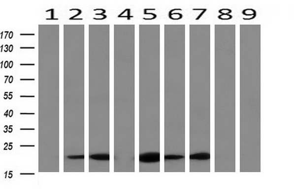 Western blot analysis of extracts (10ug) from 9 Human tissue by using anti-RBP1 monoclonal antibody at 1:200 (1: Testis; 2: Omentum; 3: Uterus; 4: Breast; 5: Brain; 6: Liver; 7: Ovary; 8: Thyroid gland; 9: colon)