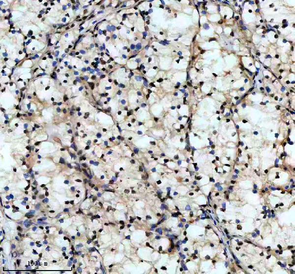 m03833 nr2f1 primary antibodies ihc testing 2
