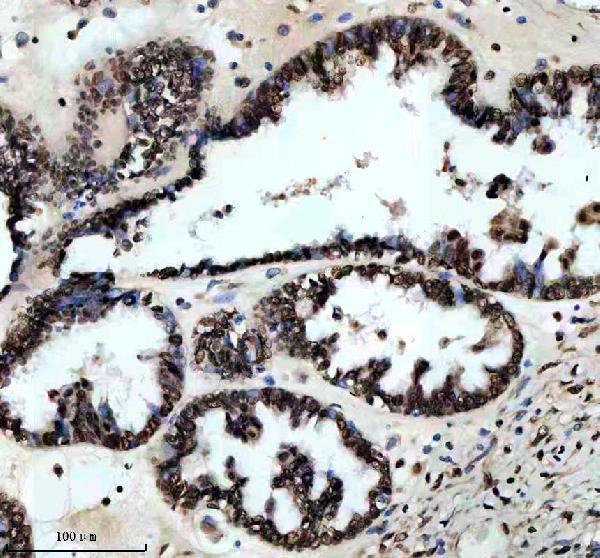 m03833 nr2f1 primary antibodies ihc testing 3