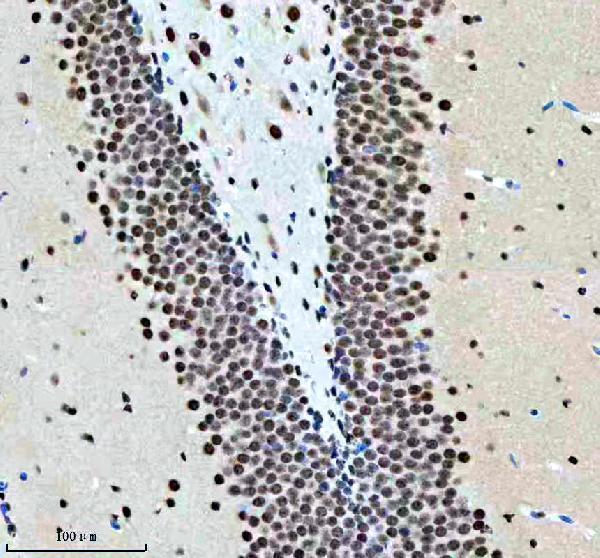 m03833 nr2f1 primary antibodies ihc testing 4