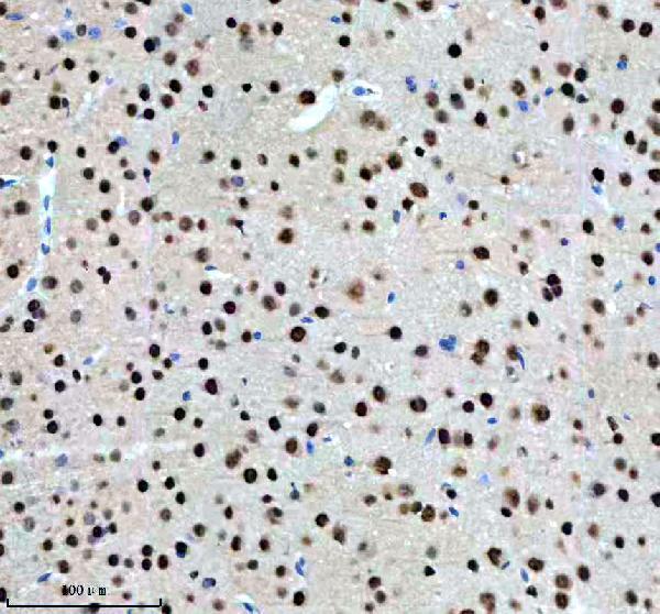 m03833 nr2f1 primary antibodies ihc testing 5