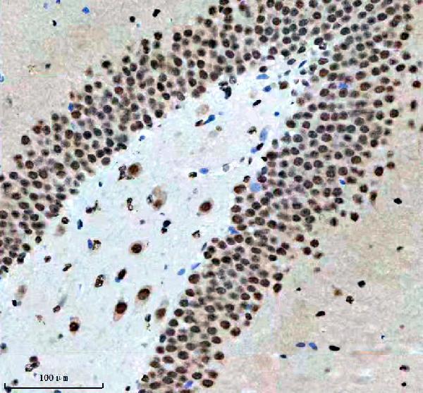 m03833 nr2f1 primary antibodies ihc testing 6