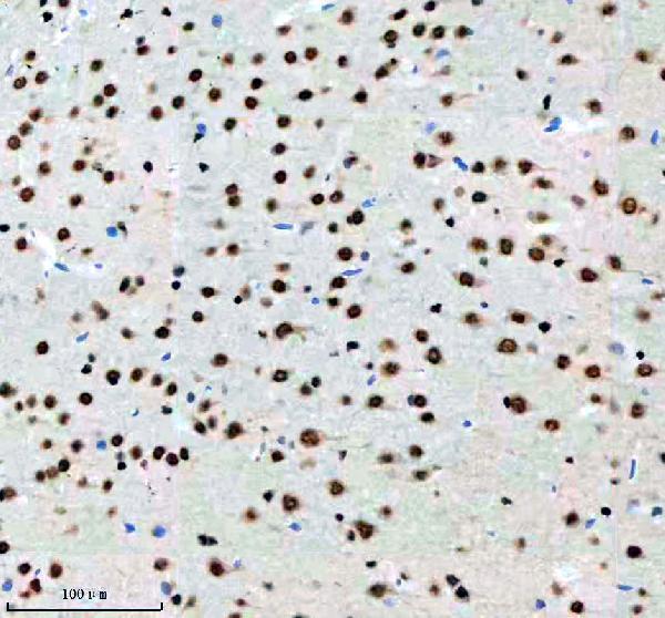 m03833 nr2f1 primary antibodies ihc testing 7