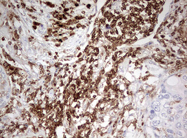 m03836 anti dock2 mouse monoclonal antibody clone id oti7g2 ihc testing 2