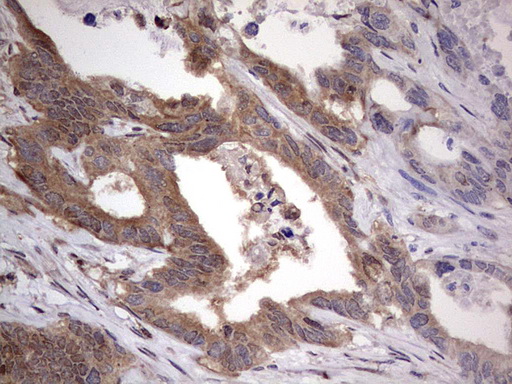 m03842 anti faf1 mouse monoclonal antibody clone id oti10d1 ihc testing 12