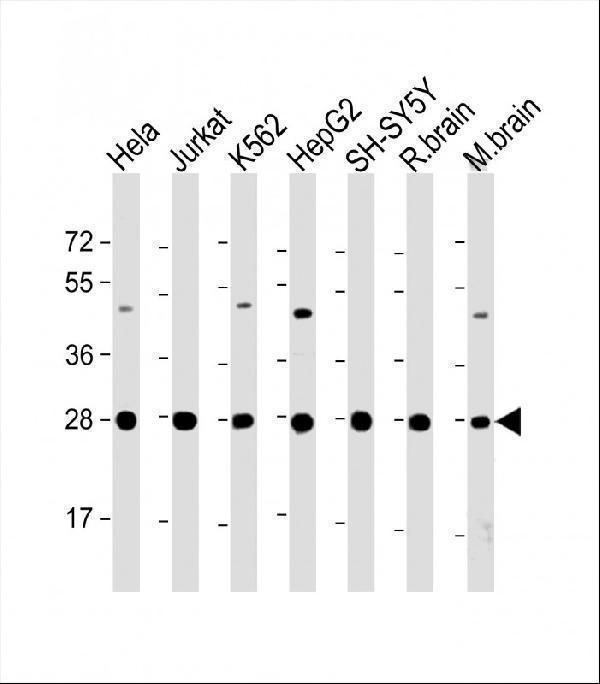 All lanes : Anti-HSD17B10 Antibody (Center) at 1:2000 dilutionLane 1: Hela whole cell lysateLane 2: Jurkat whole cell lysateLane 3: K562 whole cell lysateLane 4: HepG2 whole cell lysateLane 5: SH-SY5Y whole cell lysateLane 6: rat brain lysateLane 7: mouse brain lysateLysates/proteins at 20 µg per lane