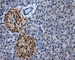m03844 2 anti erab hsd17b10 mouse monoclonal antibody clone id oti10b4 ihc testing 3
