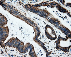 m03844 2 anti erab hsd17b10 mouse monoclonal antibody clone id oti10b4 ihc testing 4