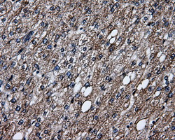 m03844 2 anti erab hsd17b10 mouse monoclonal antibody clone id oti10b4 ihc testing 6