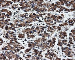 m03844 2 anti erab hsd17b10 mouse monoclonal antibody clone id oti10b4 ihc testing 7