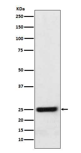 Western blot analysis of ERAB expression in HeLa cell lysate