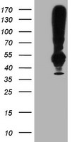 HEK293T cells were transfected with the pCMV6-ENTRY control (Left lane) or pCMV6-ENTRY TMEFF2 (Right lane) cDNA for 48 hrs and lysed