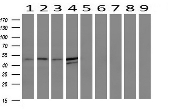 Western blot analysis of extracts (10ug) from 9 Human tissue by using anti-TMEFF2 monoclonal antibody at 1:200 (1: Testis; 2: Omentum; 3: Uterus; 4: Breast; 5: Brain; 6: Liver; 7: Ovary; 8: Thyroid gland; 9: Colon)