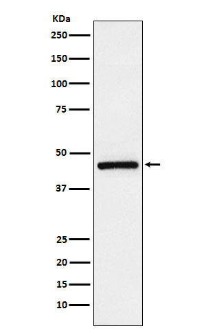 Western blot analysis of TMEFF2 expression in LnCaP cell lysate