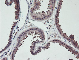 Immunohistochemical staining of paraffin-embedded Human breast tissue within the normal limits using anti-TMEFF2 mouse monoclonal antibody