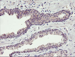 m03846 anti tmeff2 mouse monoclonal antibody clone id oti1f9 ihc testing 4