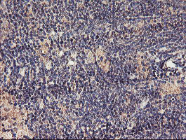 m03846 anti tmeff2 mouse monoclonal antibody clone id oti1f9 ihc testing 5