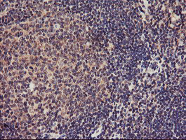 m03846 anti tmeff2 mouse monoclonal antibody clone id oti1f9 ihc testing 6
