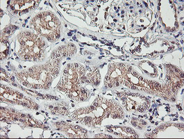 m03846 anti tmeff2 mouse monoclonal antibody clone id oti1f9 ihc testing 7