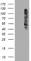 HEK293T cells were transfected with the pCMV6-ENTRY control (Left lane) or pCMV6-ENTRY TMEFF2 (Right lane) cDNA for 48 hrs and lysed