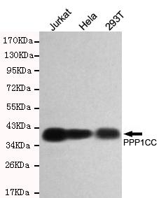 m03847 ppp1cc primary antiboties wb testing 1