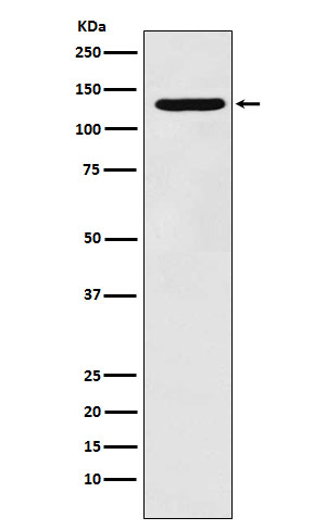 Western blot analysis of PCB expression in HepG2 cell lysate