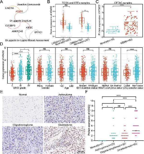 The expression of the druggable target ATAD2 in glioma