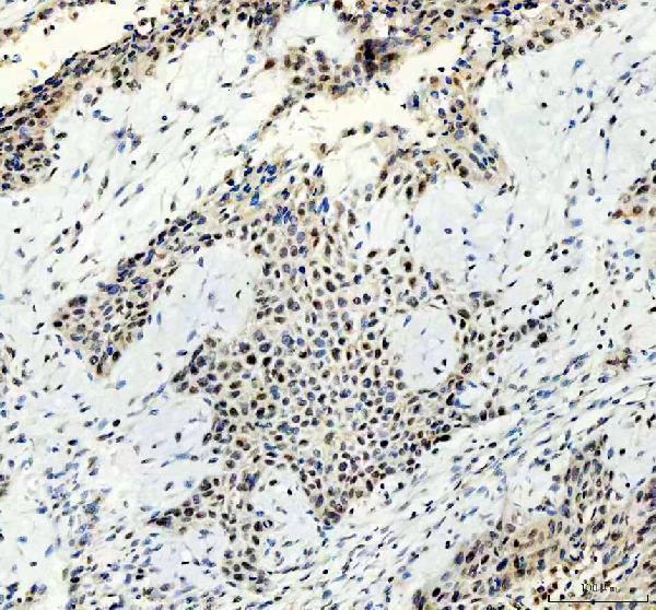  IHC analysis of ATRIP using anti-ATRIP antibody (M03862-1) 