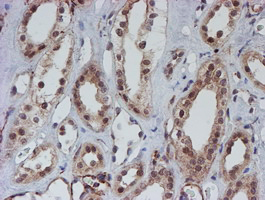 m03862 anti atrip mouse monoclonal antibody clone id oti5e7 ihc testing 10